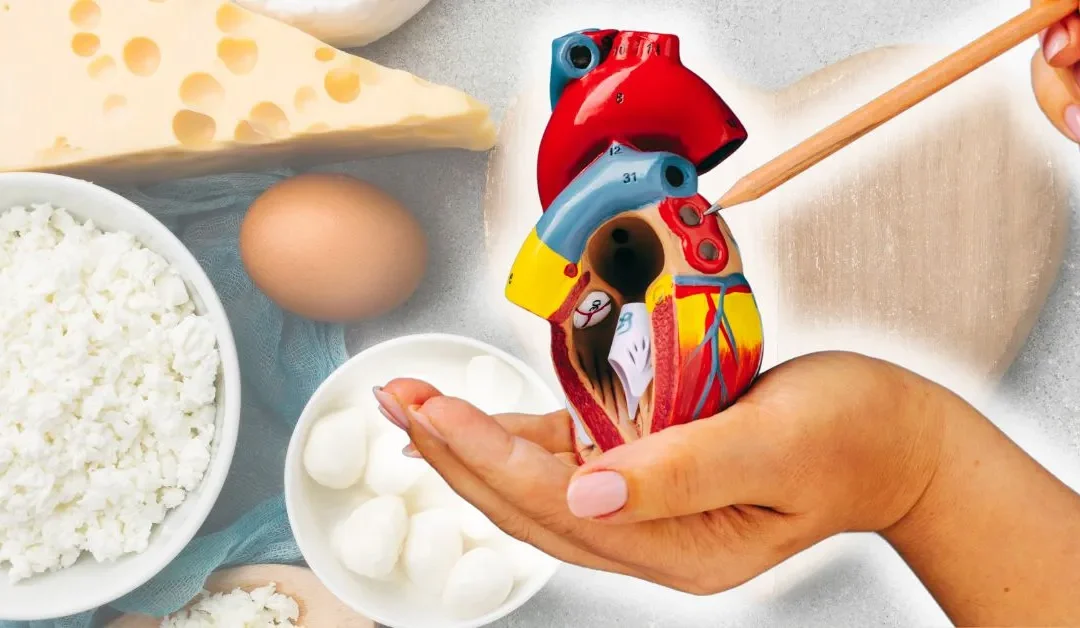 ¿El queso es malo para el colesterol?