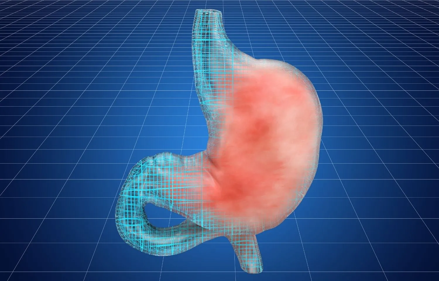 la leche afecta la gastritis la leche afecta la gastritis